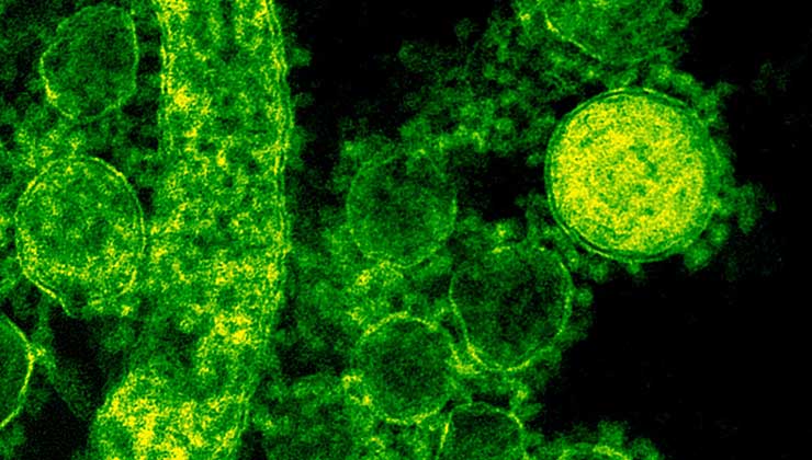 Científicos tratan de dilucidar el origen del virus SARS-Cov-2 (Foto de CDC - Pexels).